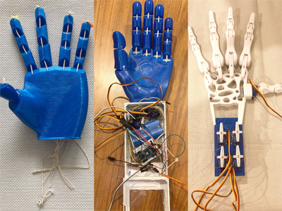 robotic prosthetic hand